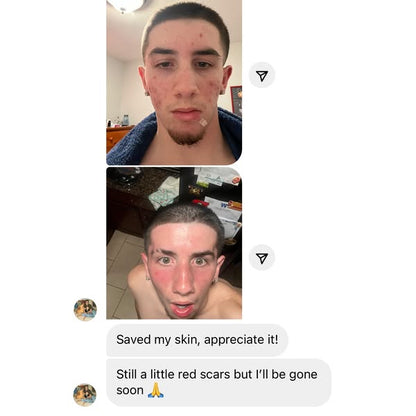 SanaClear Balm™